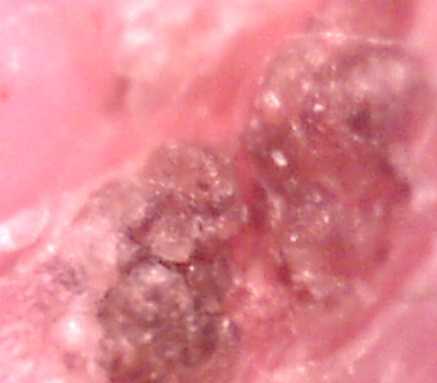 finger3 (10K)