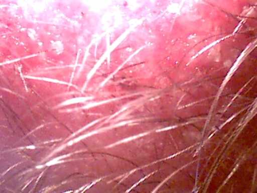 scalp1 (20K)
