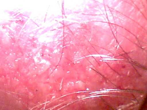 scalp2 (17K)