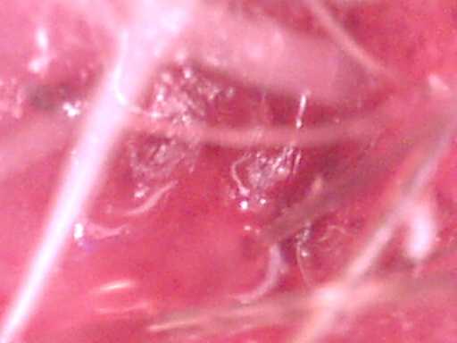 scalp4 (12K)