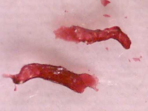 twobugsfromfinger (9K)