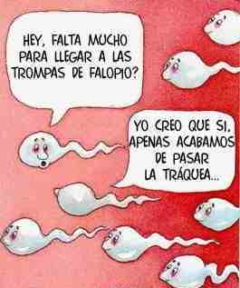 aqui hay una imagen