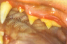 Mild Gingervitis