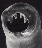 Hookworm