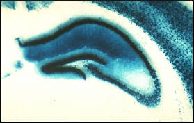 hippocampal-expression-of-camkII