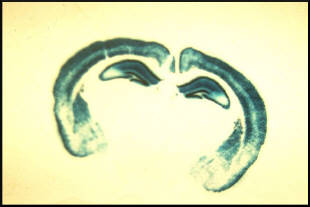 whole-brain-expression-of-camkII