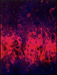 bdnf-staining-in-CA1-pyramidal-neurons
