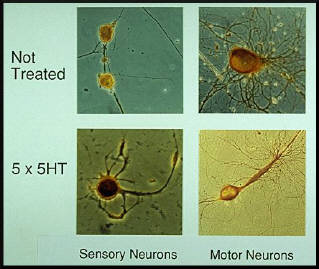 Serotonin (5HT) treatment