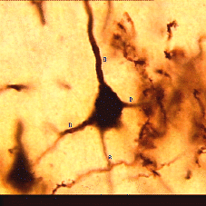 Pyramidal Cell