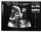 Sonogram #2