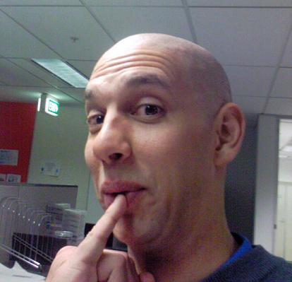 Bald Timmy in 2006