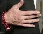Ian McKellen sports a red charm.