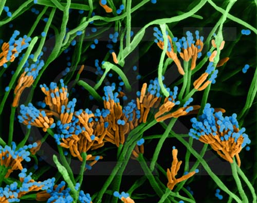 Penicillium (fausses couleurs)