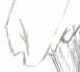 Manga - Kenshin hurt