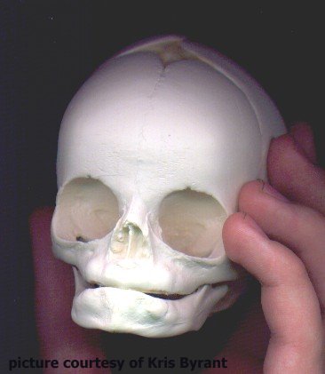 human baby skull