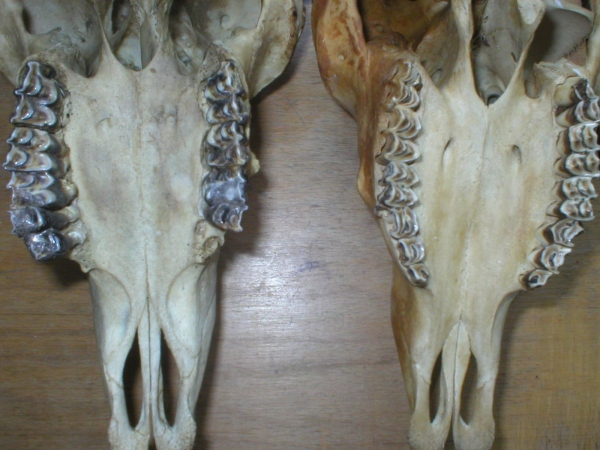 tooth wear