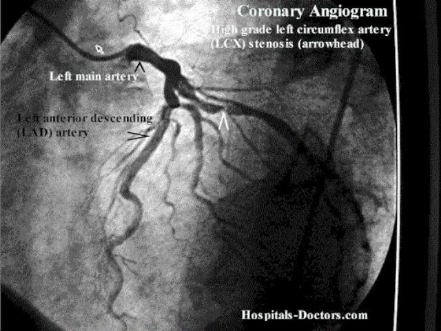 Cardiac catheterization