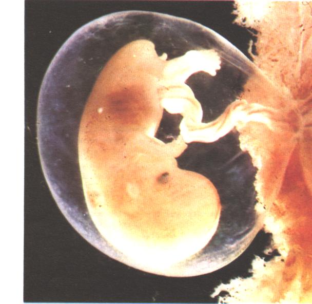 fetus.jpg (44822 bytes)