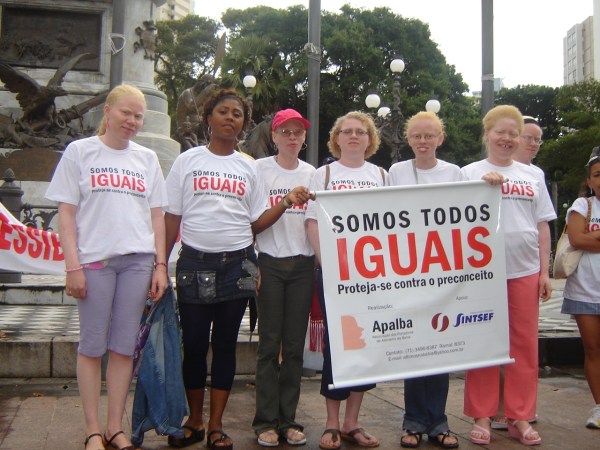 Na manifesta��o da Apalba (Associa��o dos Portadores de Albinismo da Bahia) e Cocas, o pessoal segurava uma faixa que afirmava: Somos todos iguais - proteja-se contra o preconceito.