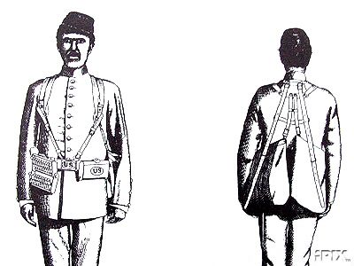 illistration of Palmer PBrace System