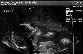 baby10-31-01A.jpg (110022 bytes)