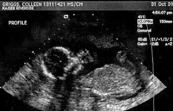 baby10-31-01B.jpg (109971 bytes)
