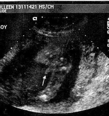 baby10-31-01D.jpg (88108 bytes)
