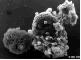 tumour cells (the site where I found this picture and more can be found by clicking on the picture
