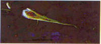 Neurona en fase de degeneraci&oacute;n