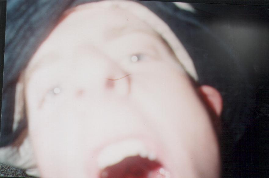 open wide