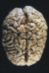 {short description of image}