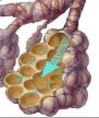 Alveoli, shaped like honey combs. Can hypnosis repair the Alveoli?
