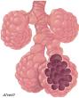Air sacks, called Alveoli.