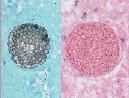 Infectious Disease Links
