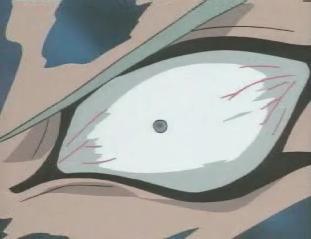 A lovely bloodshot eyeball.