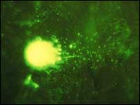 Rat brain cells, University Washington