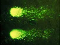 Rat brain cells, University Washington