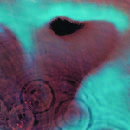 Meddle