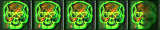 4.5 skulls