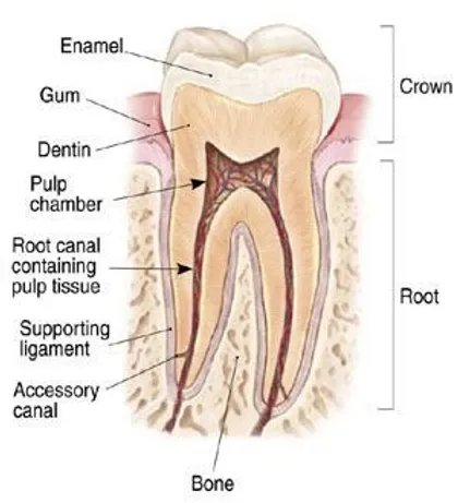 Diagram of infected tooth