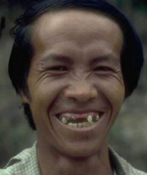 noteeth.jpg (15640 bytes)