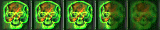 3.5 skulls