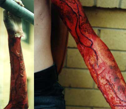 Skinned Arm