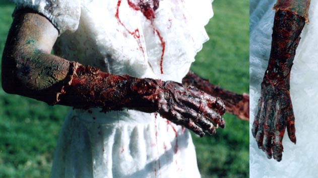 Zombie Arm