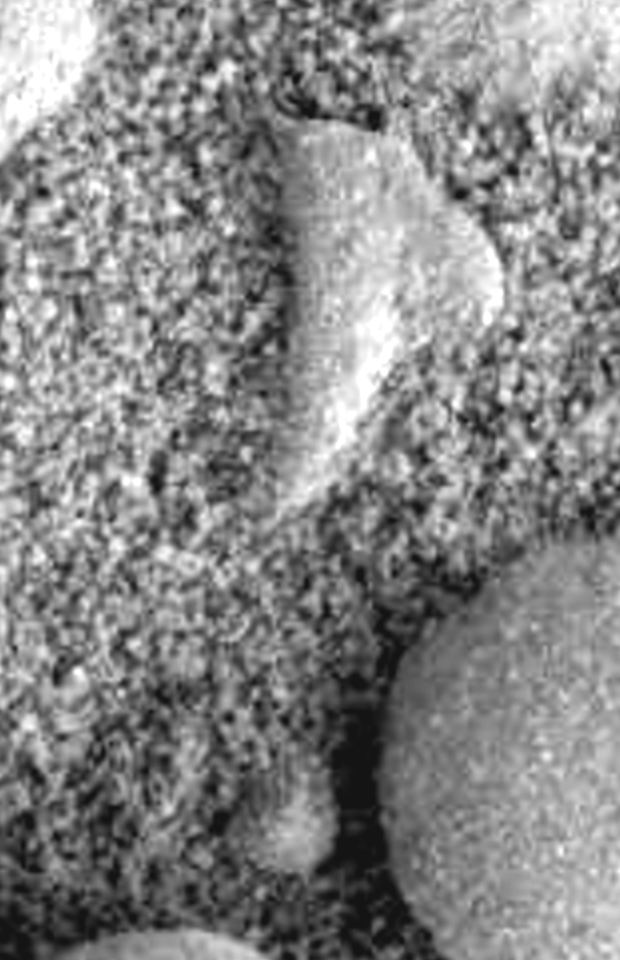 Image enlargement- left click