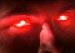 Cyclops