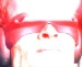 Cyclops