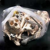 BONES