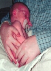 The very first pic taken of Christopher .. taken moments after his birth.