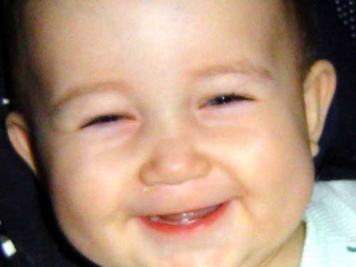 Olhem s&oacute; o meu dent&atilde;o!